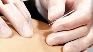finger point needling course